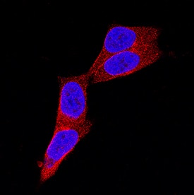 P2X7/P2RX7 antibody in WM-115 Human Cell Line by Immunocytochemistry (ICC).