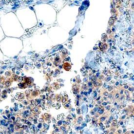 P2Y10/P2RY10 antibody in Human Thymus by Immunohistochemistry (IHC-P).
