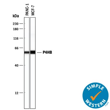 Detection of Human Protein Disulfide Isomerase/P4HB antibody by Simple WesternTM.