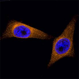 Protein Disulfide Isomerase/P4HB antibody in HeLa Human Cell Line by Immunocytochemistry (ICC).