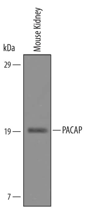 Detection of Mouse PACAP/ADCYAP1 antibody by Western Blot.