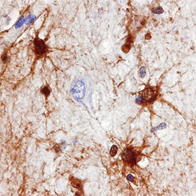 PADI2 antibody in Human Brain by Immunohistochemistry (IHC-P).