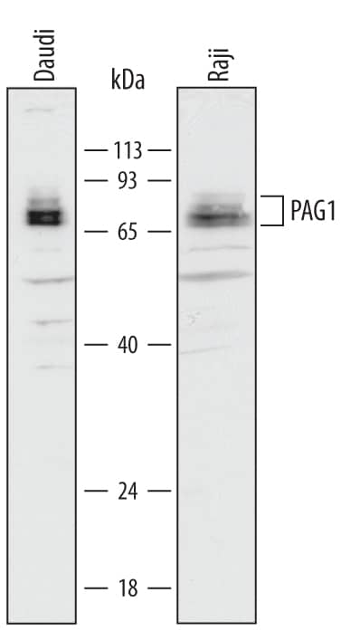 Detection of Human PAG1 antibody by Western Blot.