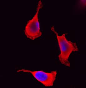 PAK1 antibody in HeLa Human Cell Line by Immunocytochemistry (ICC).