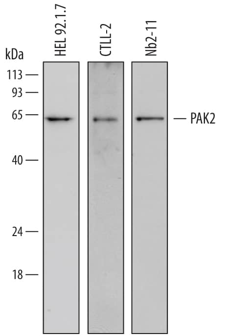 Detection of Human, Mouse, and Rat PAK2 antibody by Western Blot.