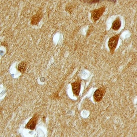PAK3 antibody in Human Brain by Immunohistochemistry (IHC-P).