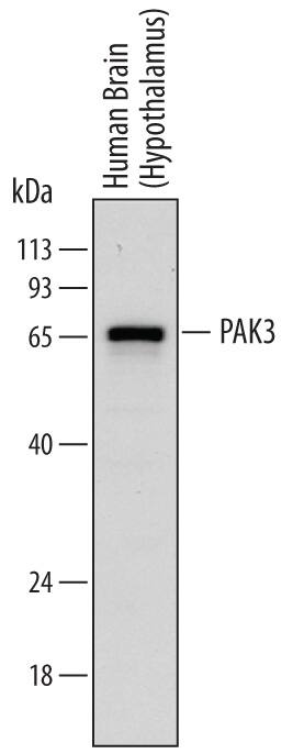 Detection of Human PAK3 antibody by Western Blot.