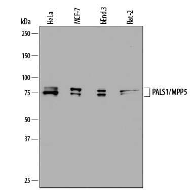 Detection of Human, Mouse, and Rat PALS1/MPP5 antibody by Western Blot.