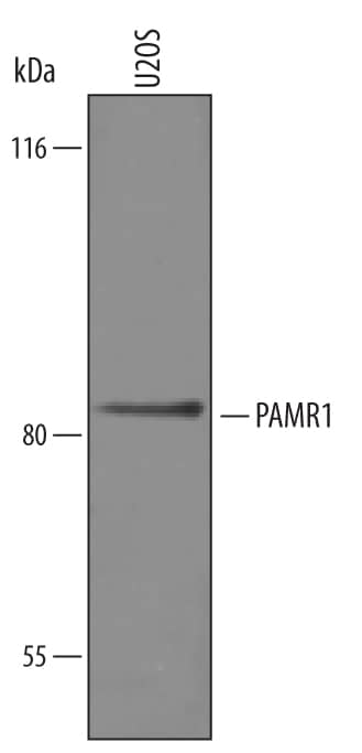 Detection of Human PAMR1 antibody by Western Blot.