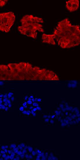 PAR1 antibody in HT-29 Human Cell Line by Immunocytochemistry (ICC).