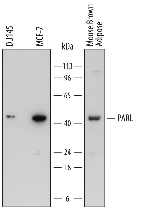 Detection of Human and Mouse PARL antibody by Western Blot.