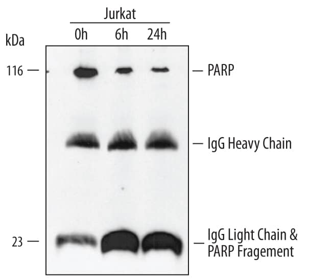 Immunoprecipitation of Human PARP.