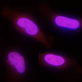 PARP antibody in HeLa Human Cell Line by Immunocytochemistry (ICC).