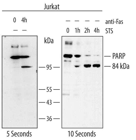 Detection of Human PARP antibody by Western Blot.