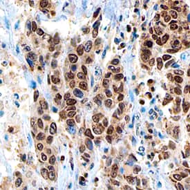PARP antibody in Human Breast by Immunohistochemistry (IHC-P).