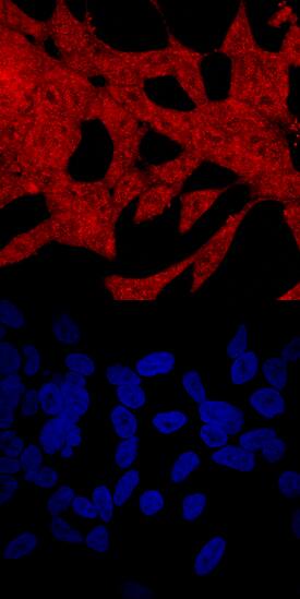 PAWR antibody in LNCaP Human Cell Line by Immunocytochemistry (ICC).