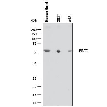 Detection of Human PBEF/Visfatin antibody by Western Blot.