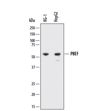 Detection of Human PBEF/Visfatin by Western Blot. Detection of Human PBEF/Visfatin antibody by Western Blot.