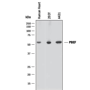 Detection of Human PBEF/Visfatin by Western Blot. Detection of Human PBEF/Visfatin antibody by Western Blot.