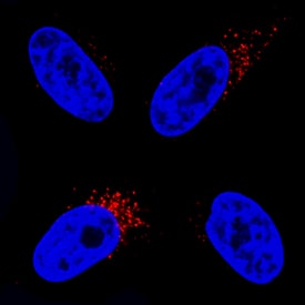 PBR antibody in HeLa Human Cell Line by Immunocytochemistry (ICC).