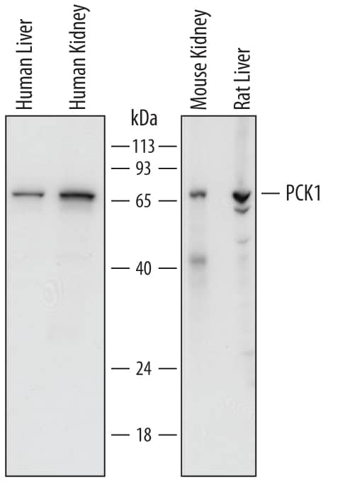 Detection of Human, Mouse, and Rat PCK1 antibody by Western Blot.