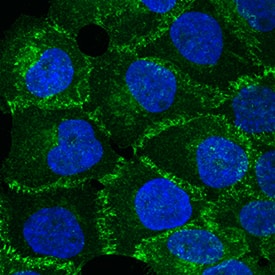 P-Cadherin antibody in A431 Human Cell Line by Immunocytochemistry (ICC).