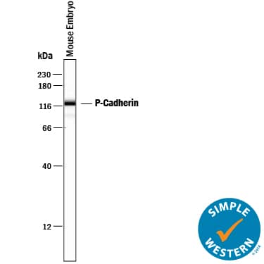 Detection of Mouse P-Cadherin antibody by Simple WesternTM.