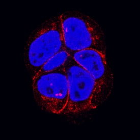 P-Cadherin antibody in MCF-7 Human Cell Line by Immunocytochemistry (ICC).