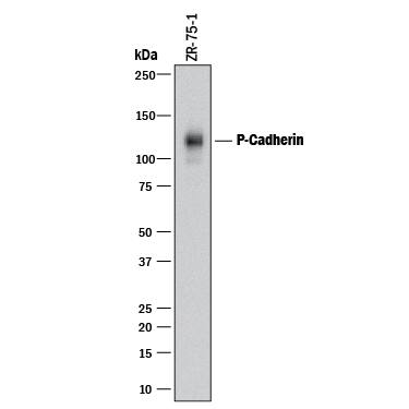 Detection of Human P-Cadherin antibody by Western Blot.