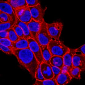 P-Cadherin antibody in A431 Human Cell Line by Immunocytochemistry (ICC).