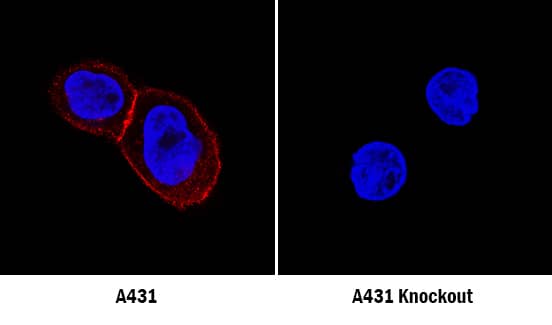 P-Cadherin Antibody Specificity is Shown by Immunocytochemistry antibody in Knockout Cell Line.
