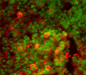 PD-1 antibody in Mouse Thymus by Immunohistochemistry (IHC-Fr).