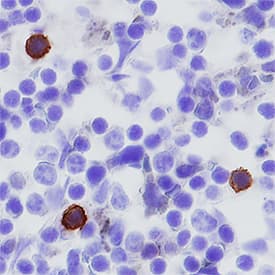PD-1 antibody in Mouse Spleen by Immunohistochemistry (IHC-Fr).