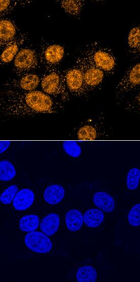 PDCD4 antibody in MCF-7 Human Cell Line by Immunocytochemistry (ICC).