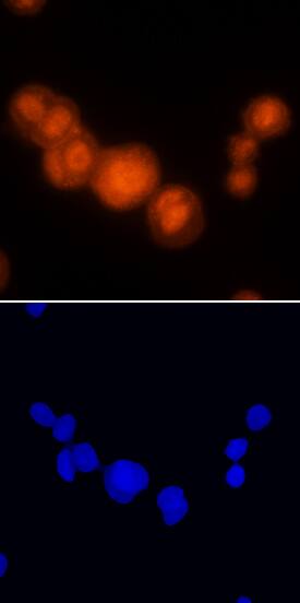 PDCD4 antibody in MCF-7 Human Cell Line by Immunocytochemistry (ICC).