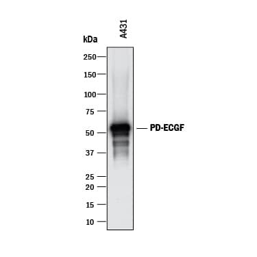 Detection of Human PD-ECGF/Thymidine Phosphorylase antibody by Western Blot.