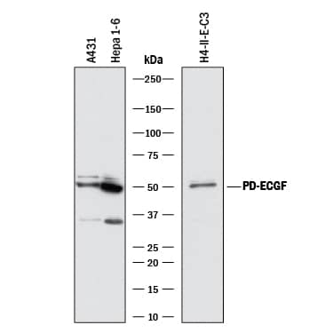 Detection of Human, Mouse, and Rat PD-ECGF/Thymidine Phosphorylase antibody by Western Blot.