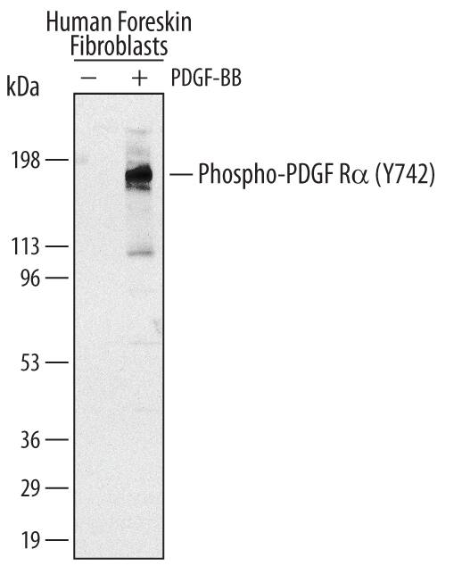 Detection of Human Phospho-PDGF Ra (Y742) antibody by Western Blot.