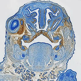 PDGF R beta antibody in Mouse Embryo by Immunohistochemistry (IHC-Fr).