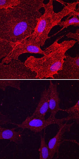 Phospho-PDGF R beta (Y751) antibody in BJ Human Cell Line by Immunocytochemistry (ICC).