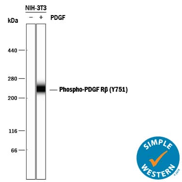 Detection of Mouse Phospho-PDGF R beta (Y751) antibody by Simple WesternTM.