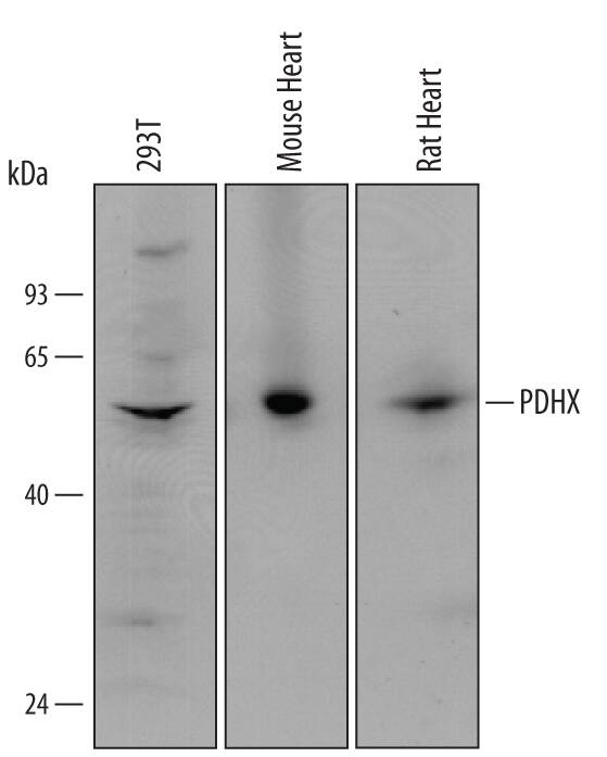 Detection of Human, Mouse, and Rat PDHX antibody by Western Blot.