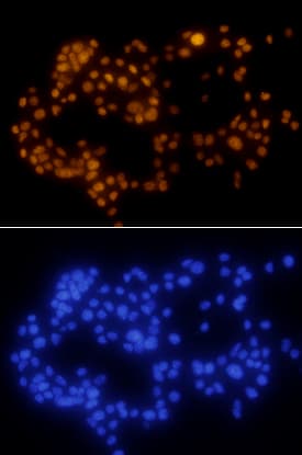 PDX-1/IPF1 antibody in  betaTC-6 Mouse Cell Line by Immunocytochemistry (ICC).