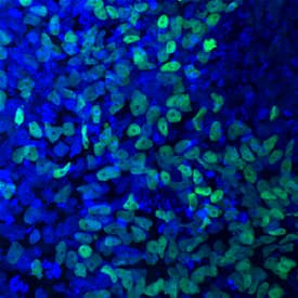 PDX-1/IPF1 antibody in BG01V Human Embryonic Stem Cells by Immunocytochemistry (ICC).