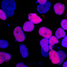 PDX-1/IPF1 antibody in BG01V Human Embryonic Stem Cells by Immunocytochemistry (ICC).