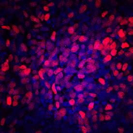 PDX-1/IPF1 antibody in BG01V Human Embryonic Stem Cells by Immunocytochemistry (ICC).