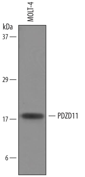 Detection of Human PDZD11 antibody by Western Blot.