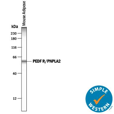 Detection of Mouse PEDF R/PNPLA2 antibody by Simple WesternTM.