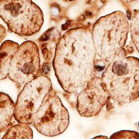 PEDF R/PNPLA2 antibody in Human Heart by Immunohistochemistry (IHC-P).