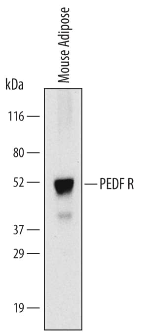 Detection of Mouse PEDF R/PNPLA2 antibody by Western Blot.